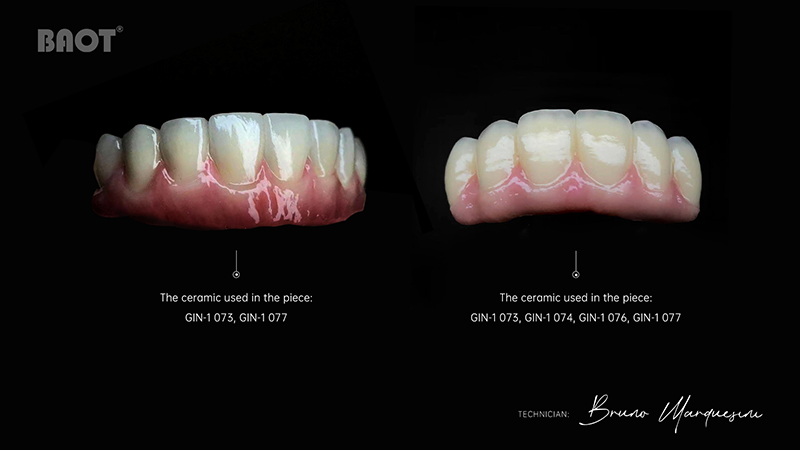 dental ceramic powder PFZ for gingiva tissue
