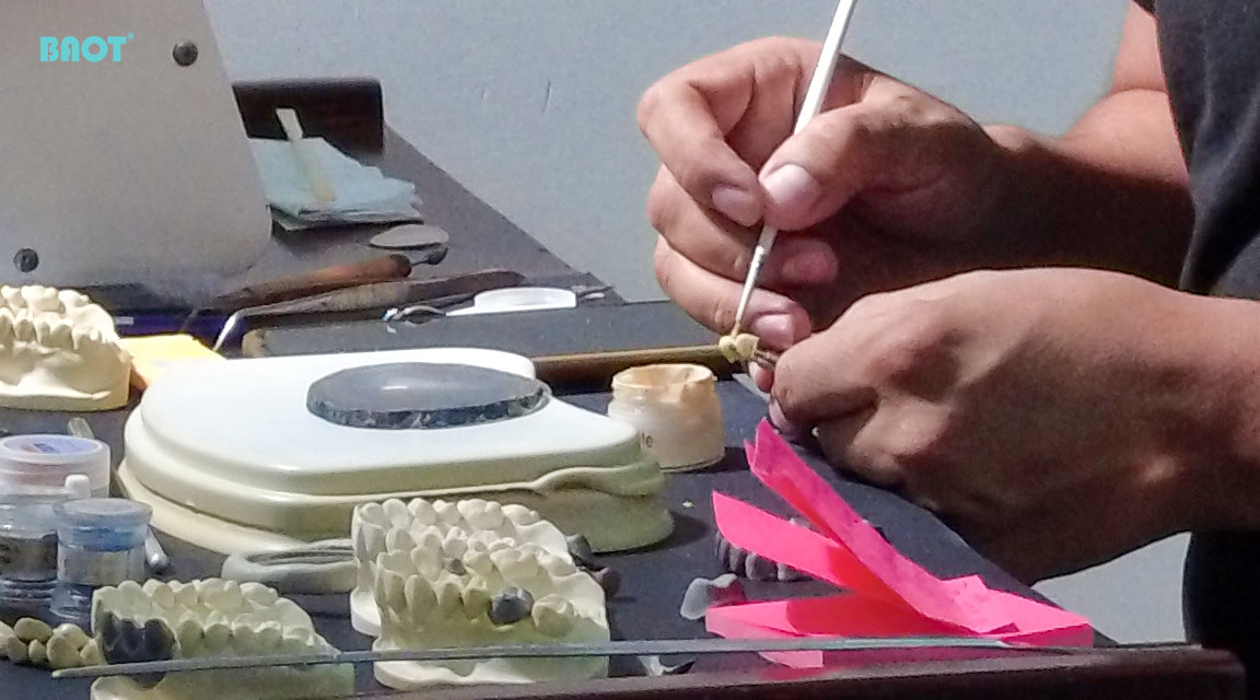 metal ceramic dental ceramics manufacturer