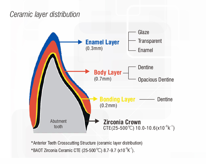 Dental Porcelain Powder for Ceramics layer